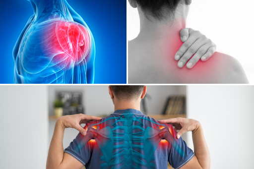 Common Causes of Pain in the Shoulder Blade