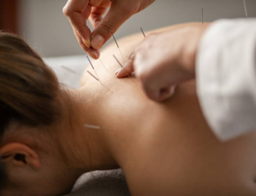 How Much Does Acupuncture Cost in Brampton?