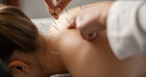 cost of acupuncture in brampton