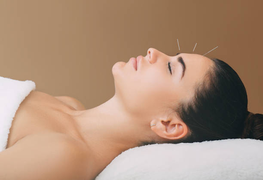 cost of acupuncture session in brampton