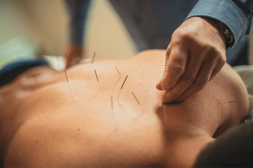 acupuncture for weight loss