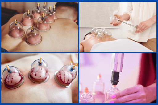 Types of Ventosa Therapy