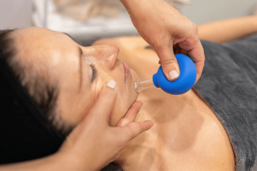 What is Facial Cupping Therapy