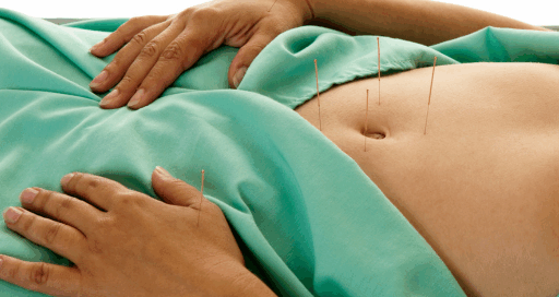acupuncture for weight loss