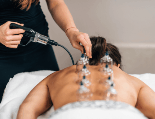 Top Benefits of Cupping Therapy: How It Works, Types & Safety