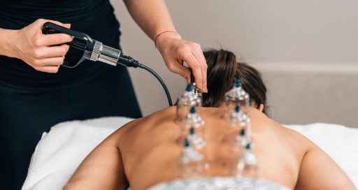 Benefits of Cupping Therapy