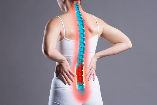 What Is Sciatica